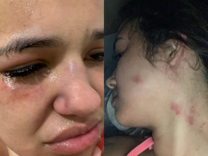 Beatriz Ramos, moradora de Niterói, denuncia agressões com fotos e vídeo e registra boletim de ocorrência contra ex-namorado