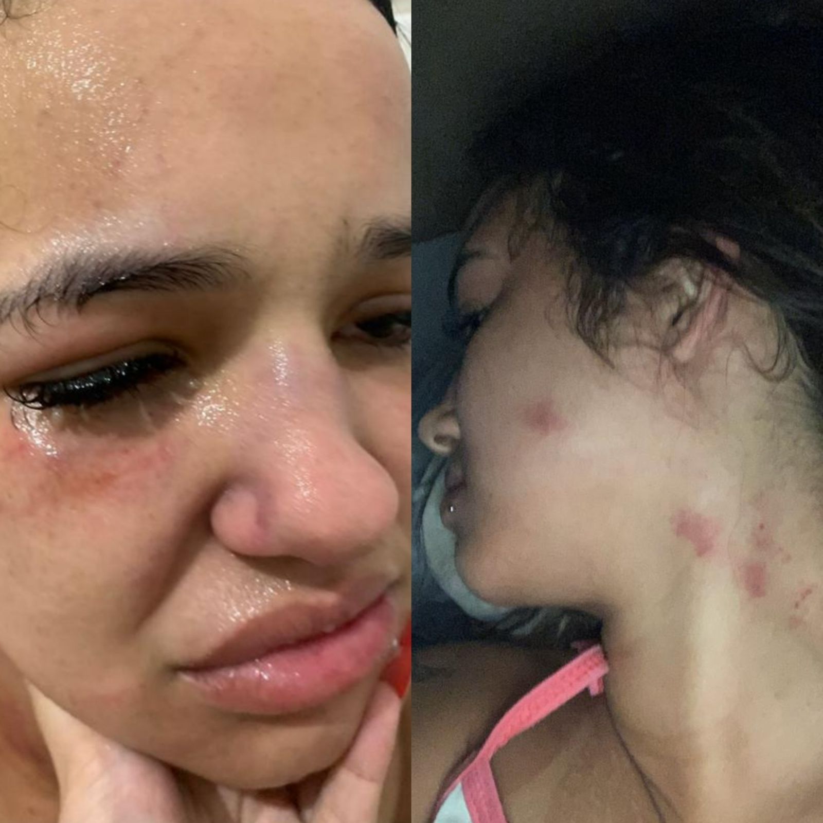 Beatriz Ramos, moradora de Niterói, denuncia agressões com fotos e vídeo e registra boletim de ocorrência contra ex-namorado