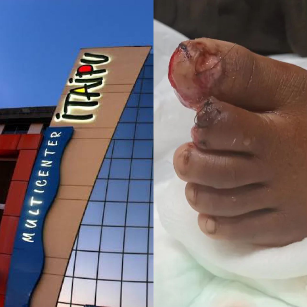 Tragédia no shopping: menino de 7 anos perde parte do dedo em escada rolante no Itaipu Multicenter, em Niterói