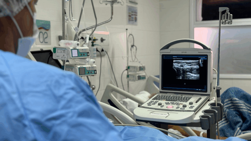 Hospital Dr. Ernesto Che Guevara realizou a primeira inserção de cateter de linha média por ultrassom