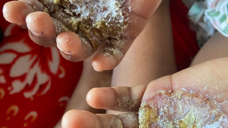 Covardia: Mulher é presa em comunidade de Niterói acusada de torturar filha de 9 anos com ovos ferventes