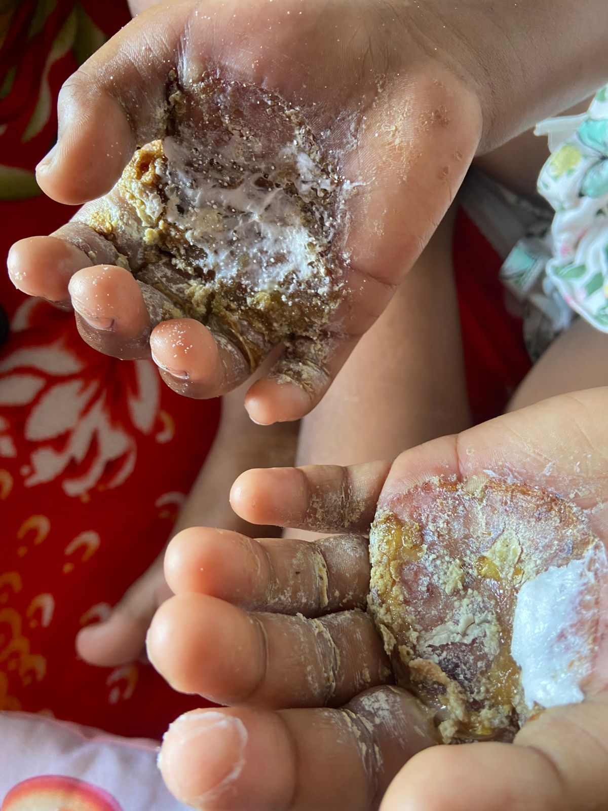 Covardia: Mulher é presa em comunidade de Niterói acusada de torturar filha de 9 anos com ovos ferventes