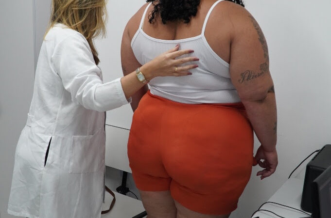 São Gonçalo oferece tratamento para obesidade grave na rede municipal de Saúde