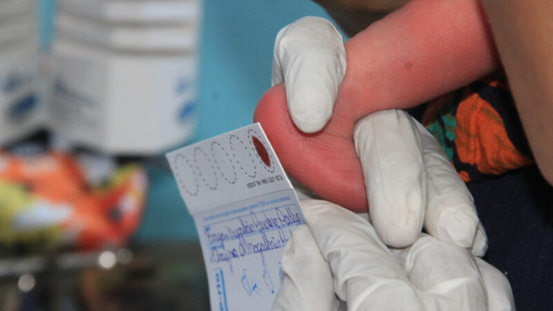 Saúde de São Gonçalo alerta para importância do teste do pezinho