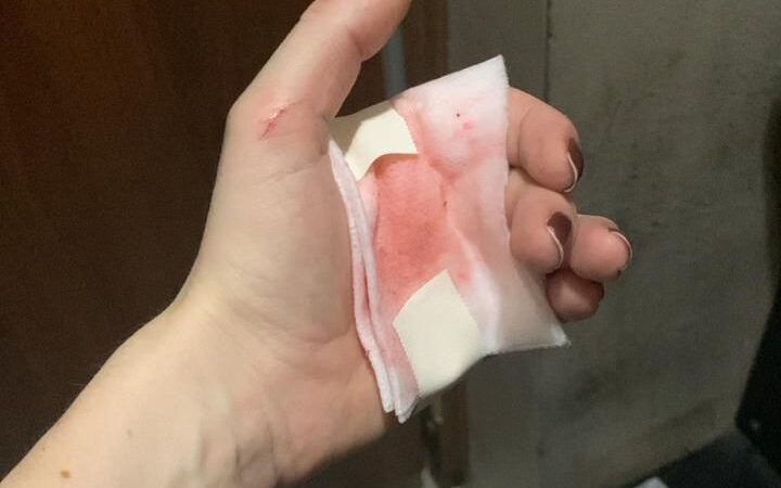 Ação integrada do 12º BPM e da 77º DP prende dupla que atacou mulher com faca no Campo de São Bento