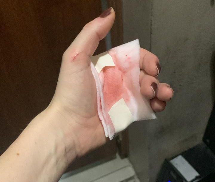 Ação integrada do 12º BPM e da 77º DP prende dupla que atacou mulher com faca no Campo de São Bento