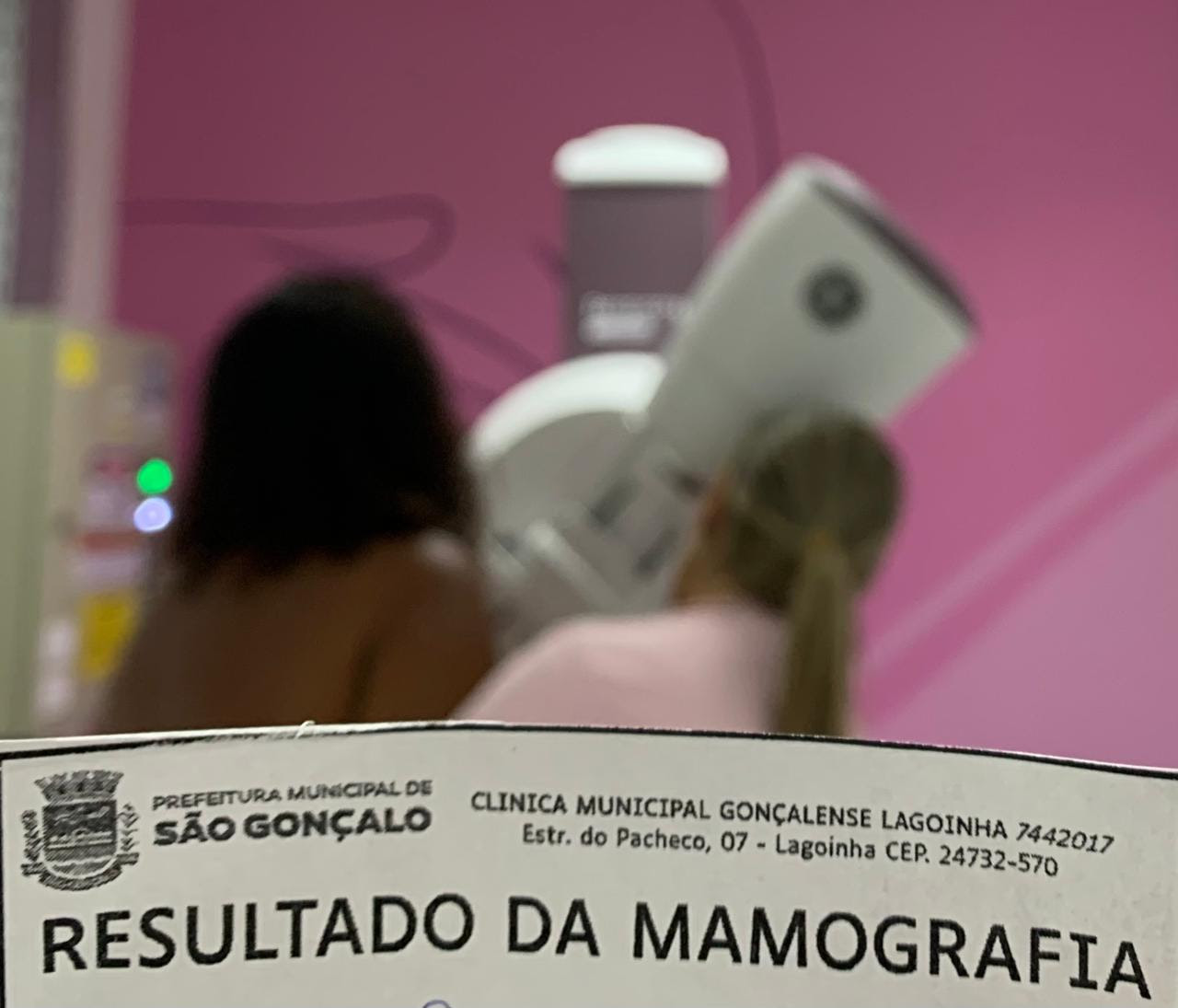 Clínica da Lagoinha já faz exames para diagnóstico precoce do câncer de mama