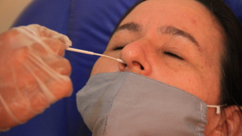 São Gonçalo mantém oferta de testes de covid-19