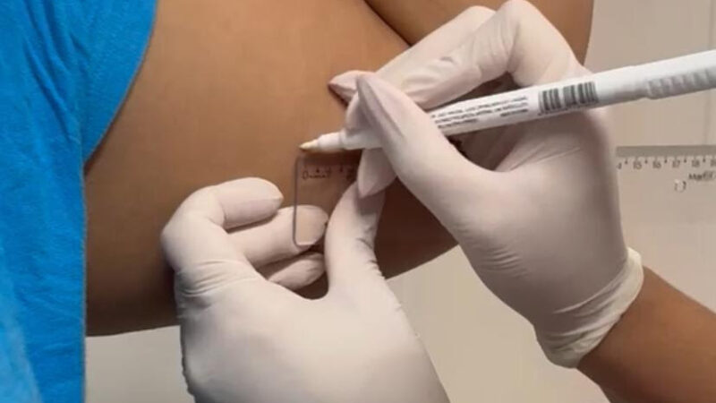São Gonçalo faz mutirão para colocação de anticoncepcional subdérmico